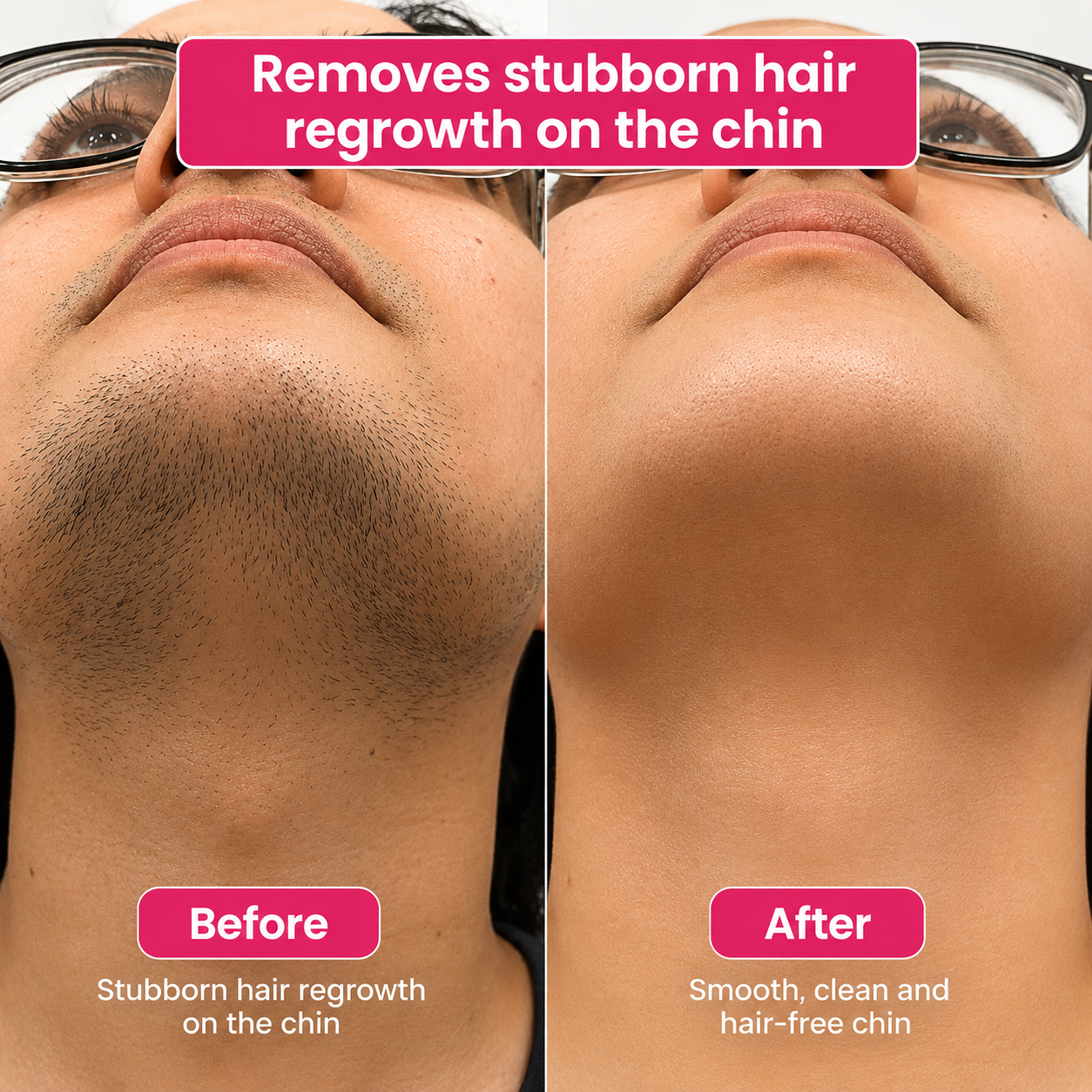 🔥LAST DAY 60% OFF  Vopani Hair Reduction Oil 60 ml – Permanent Hair Removal Oil