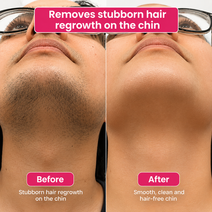🔥LAST DAY 60% OFF  Vopani Hair Reduction Oil 60 ml – Permanent Hair Removal Oil